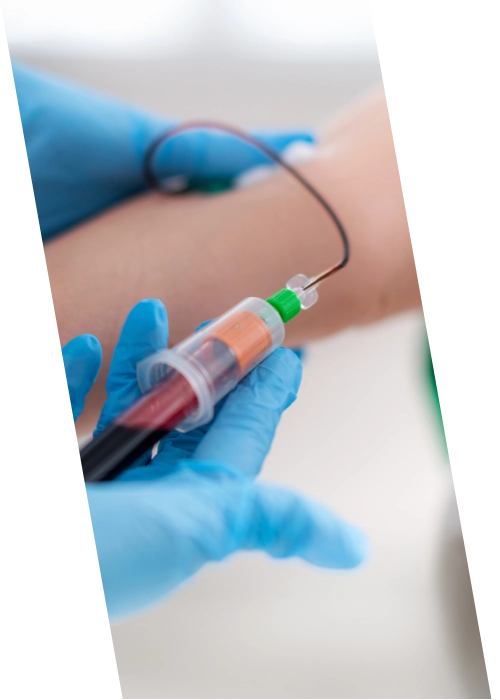 Toma de muestra de sangre
